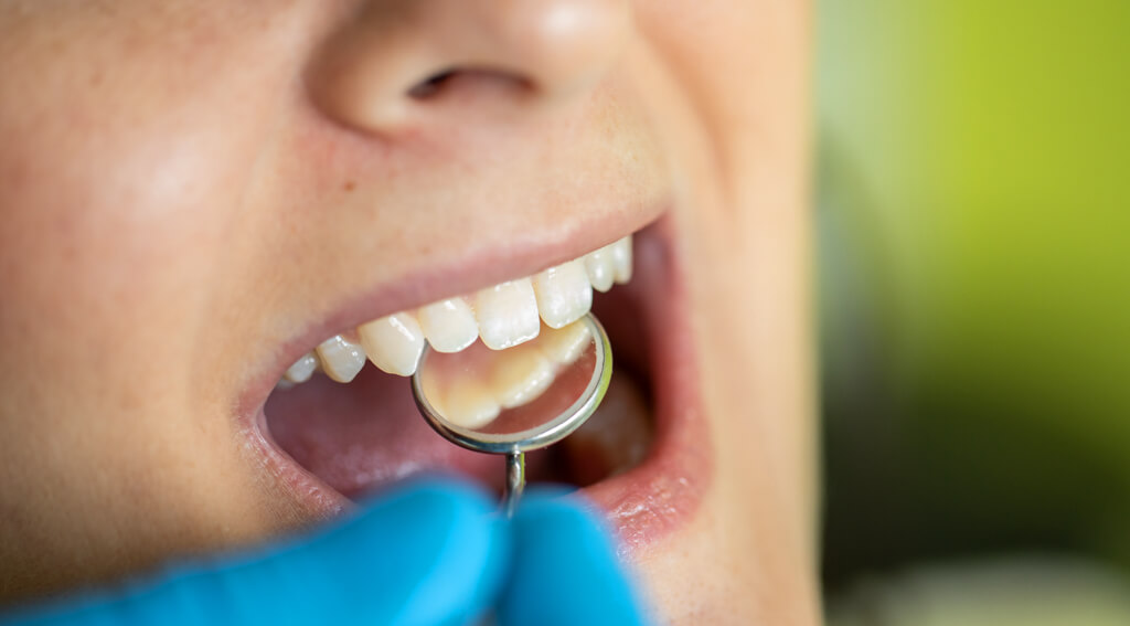 Prophylaxe - Zahnarztpraxis Dr. med. dent. Hilpert